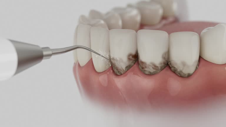 Reliable Dental Implants contractor in Smith Center, KS by Smile Center Dentistry
